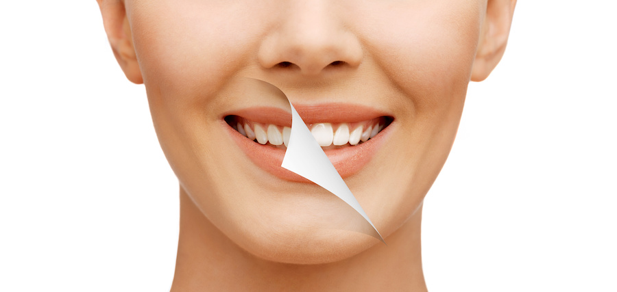 Dott. Indaco Studio Lembo Estetica del Sorriso