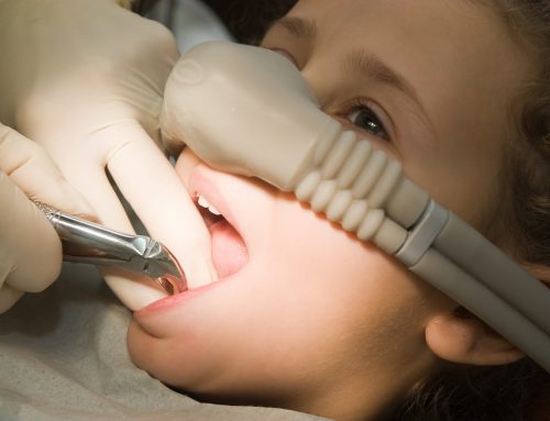 La sedazione cosciente dall’odontoiatra con il Protossido di Azoto